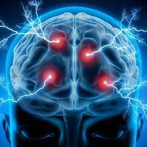 epilepsy fits treatment in ongole