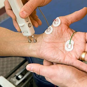 neuropathy specialist in ongole